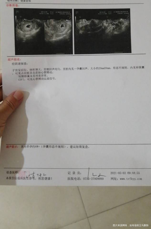 医生你好帮我看看b超单b超单上说孕囊偏小严重