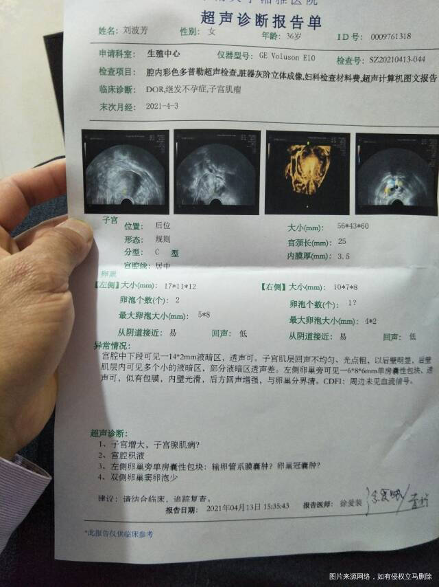 卵泡少卵巢早衰像这样还可能怀孕吗