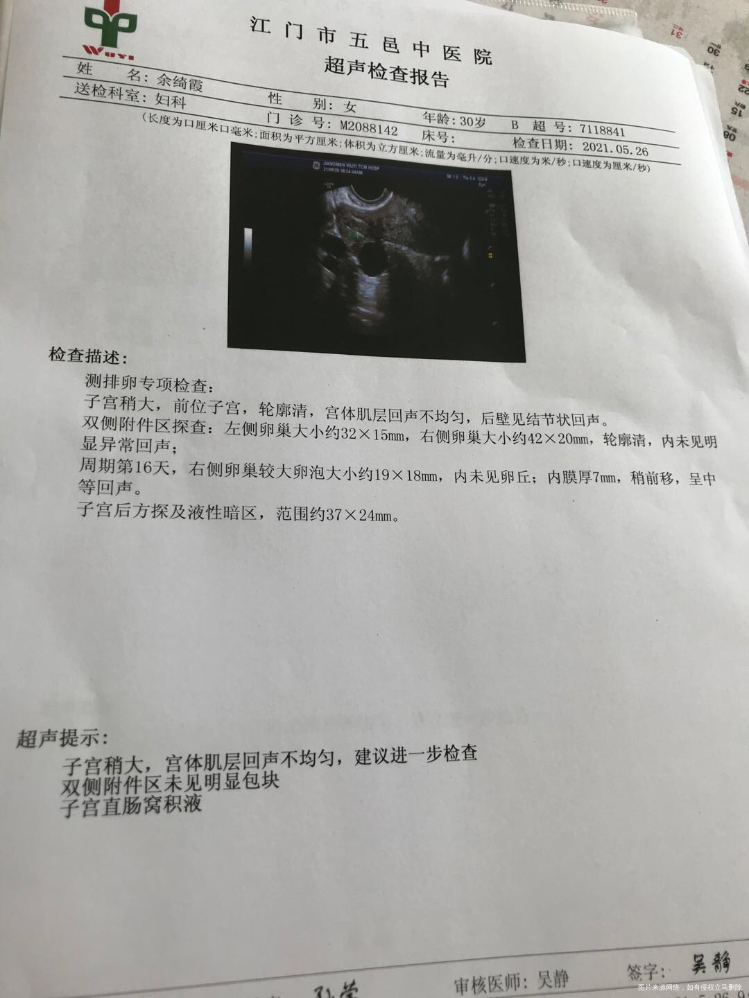 511517月经期平时周期2526天按道理6