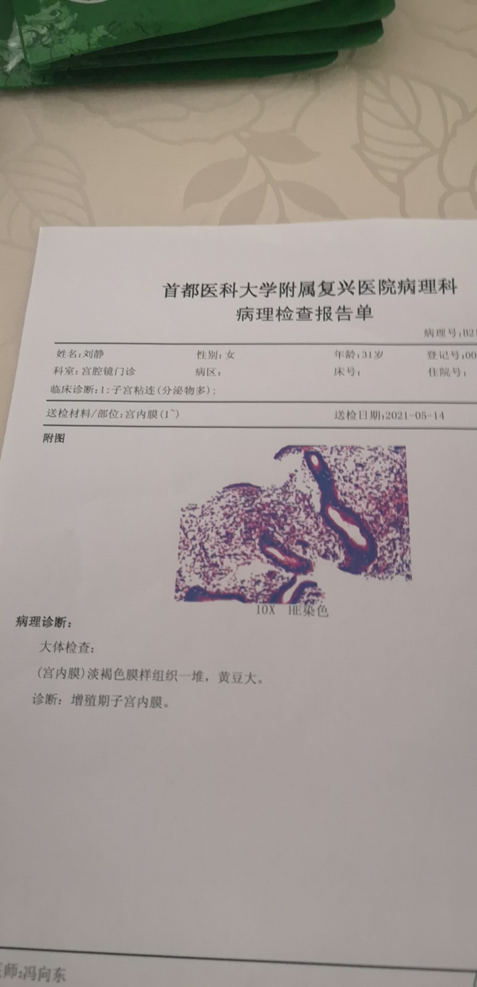 我已预约您6月7日的宫腔镜手术通知我3号去术