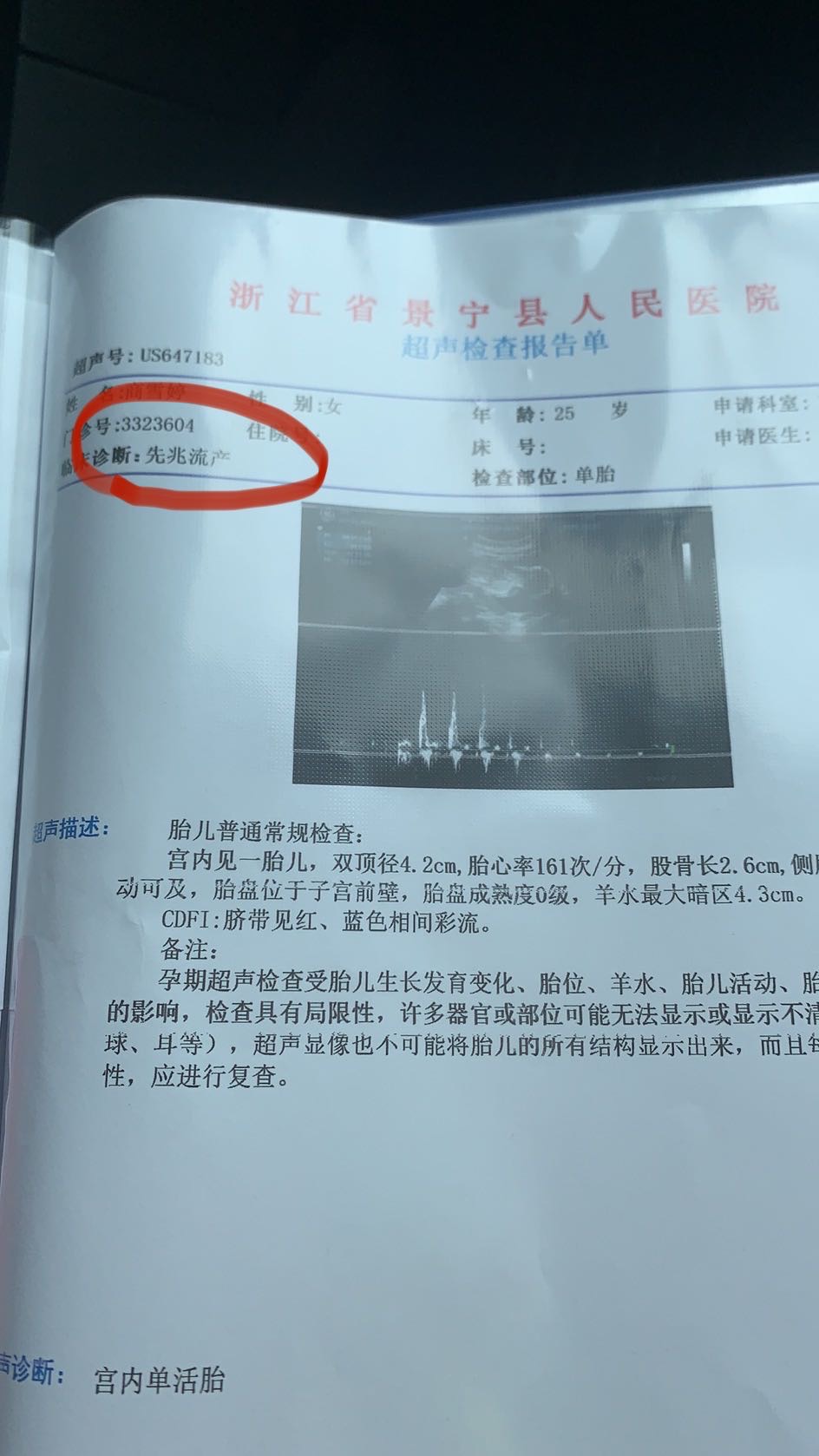 51见红肚子不痛B超正常52少量分泌物医生说