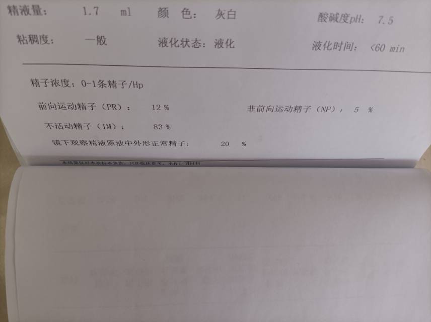 严重的少弱精子症染色体无异常Y染色体微缺失未