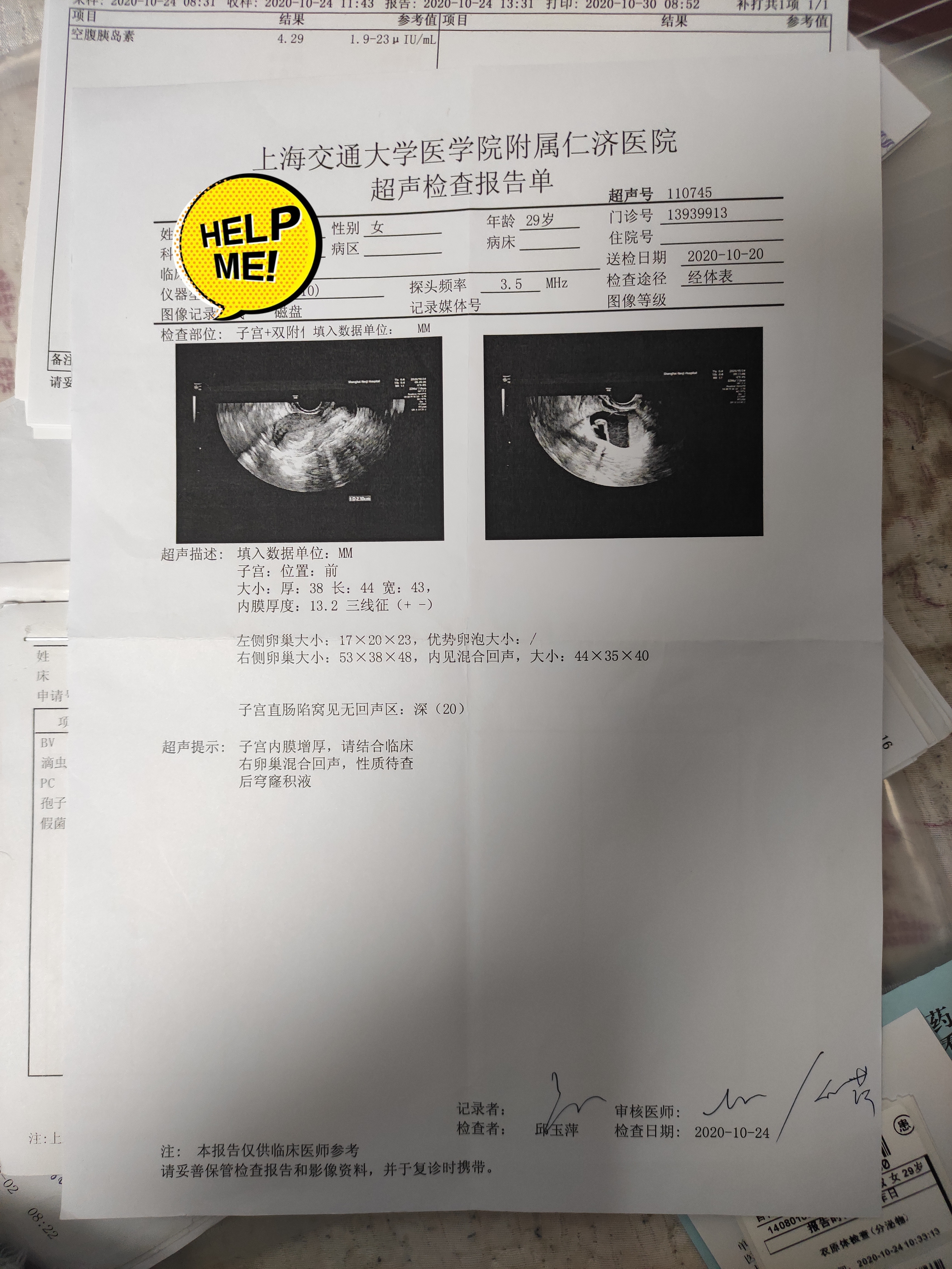 我一直有慢性宫颈炎白带黄色脓性也一直右侧有卵