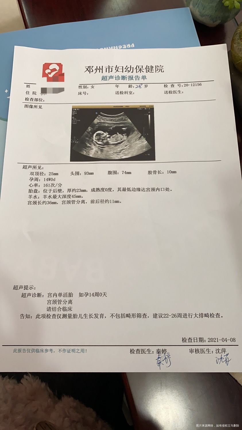 目前怀孕19周2天晚上上厕所出现这种分泌物是