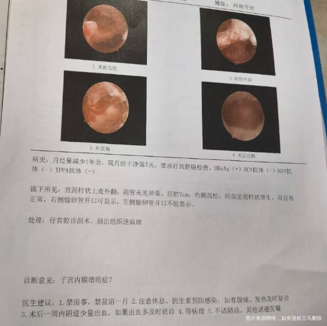 备孕1年从来没怀过在当地二甲医院做了输卵管自