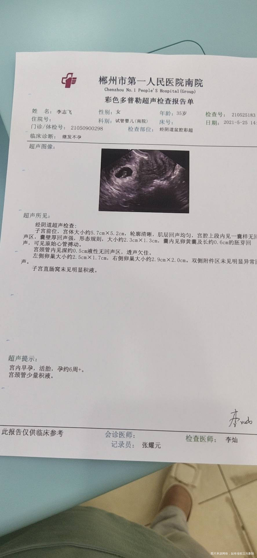 请问医生我这份检查报告有没有问题的