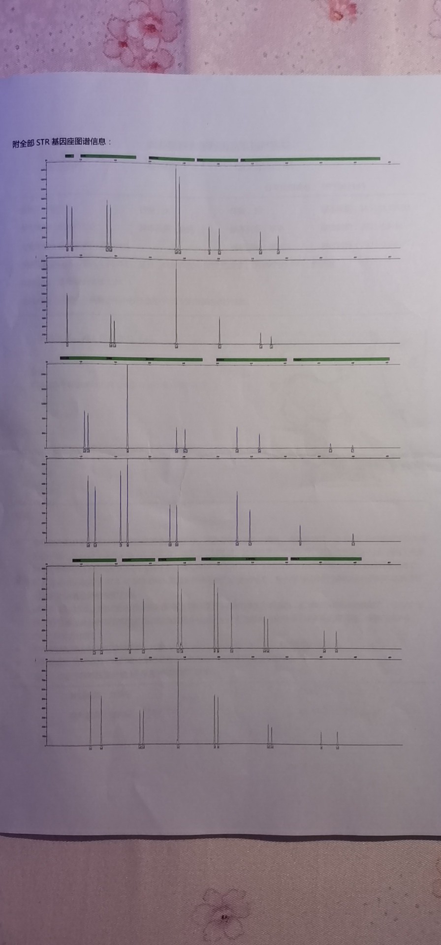 试管多次移植成功后却胎停了胚胎质量不好如何在