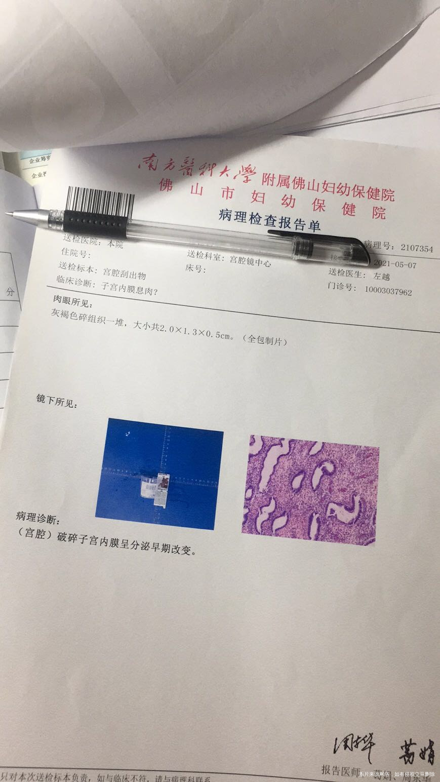 我2021年5月7日做宫腔镜手术做完直接回家