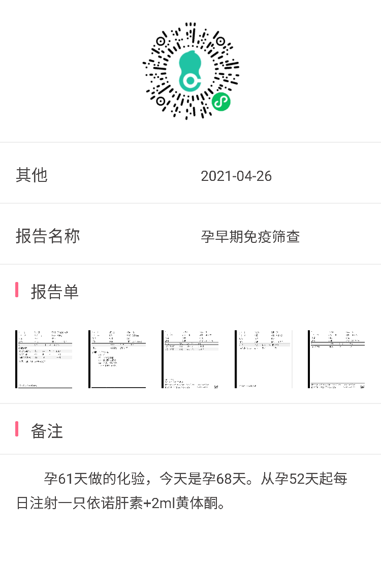 4月24日:甲状腺T3T4正常TSH37甲状