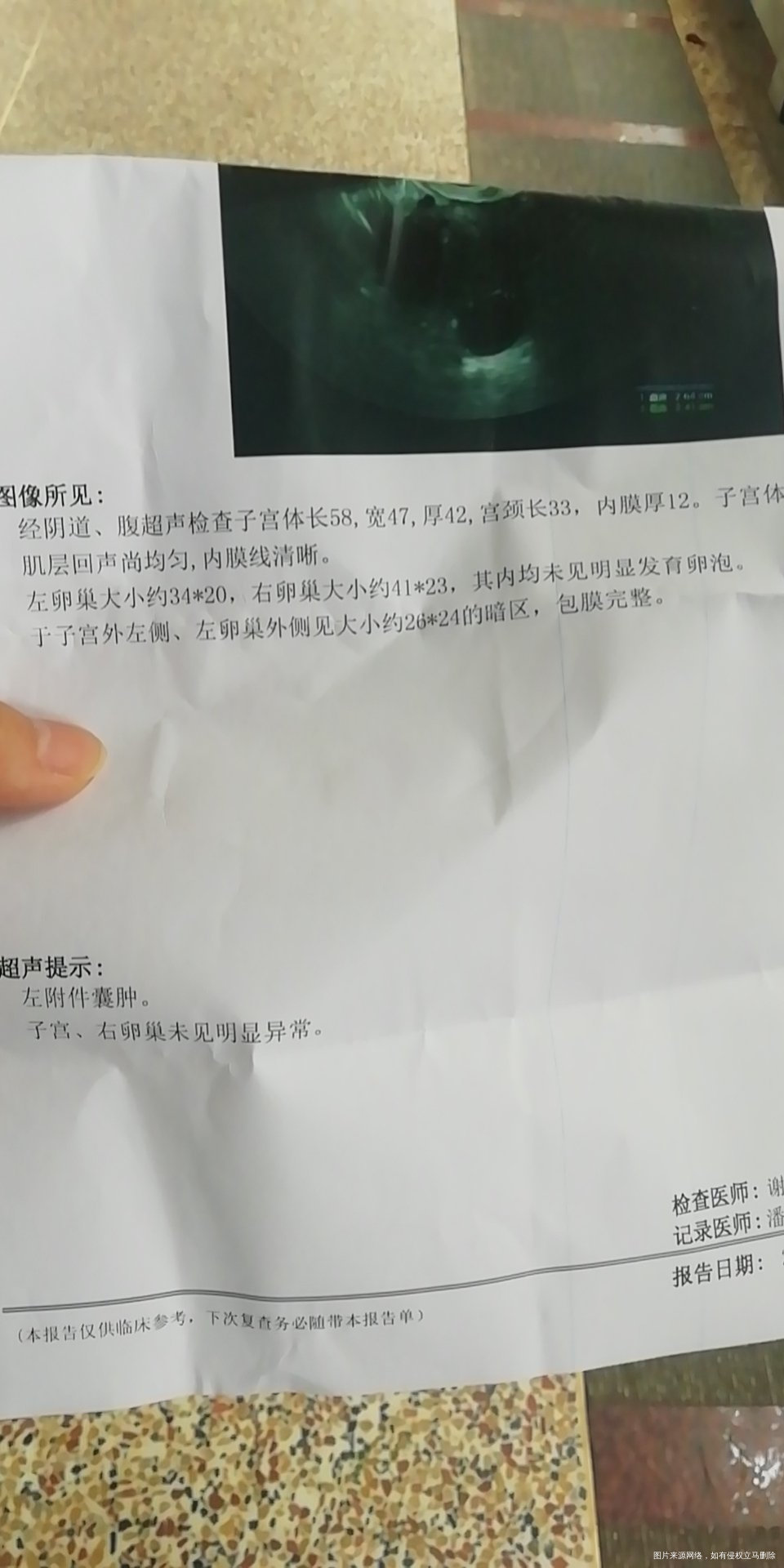 本月吃来曲唑促排511阴超查1818优势卵泡