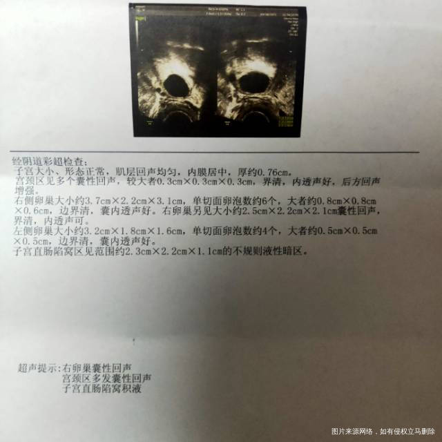 月经第10天检测大夫让同房然后第11天又去检