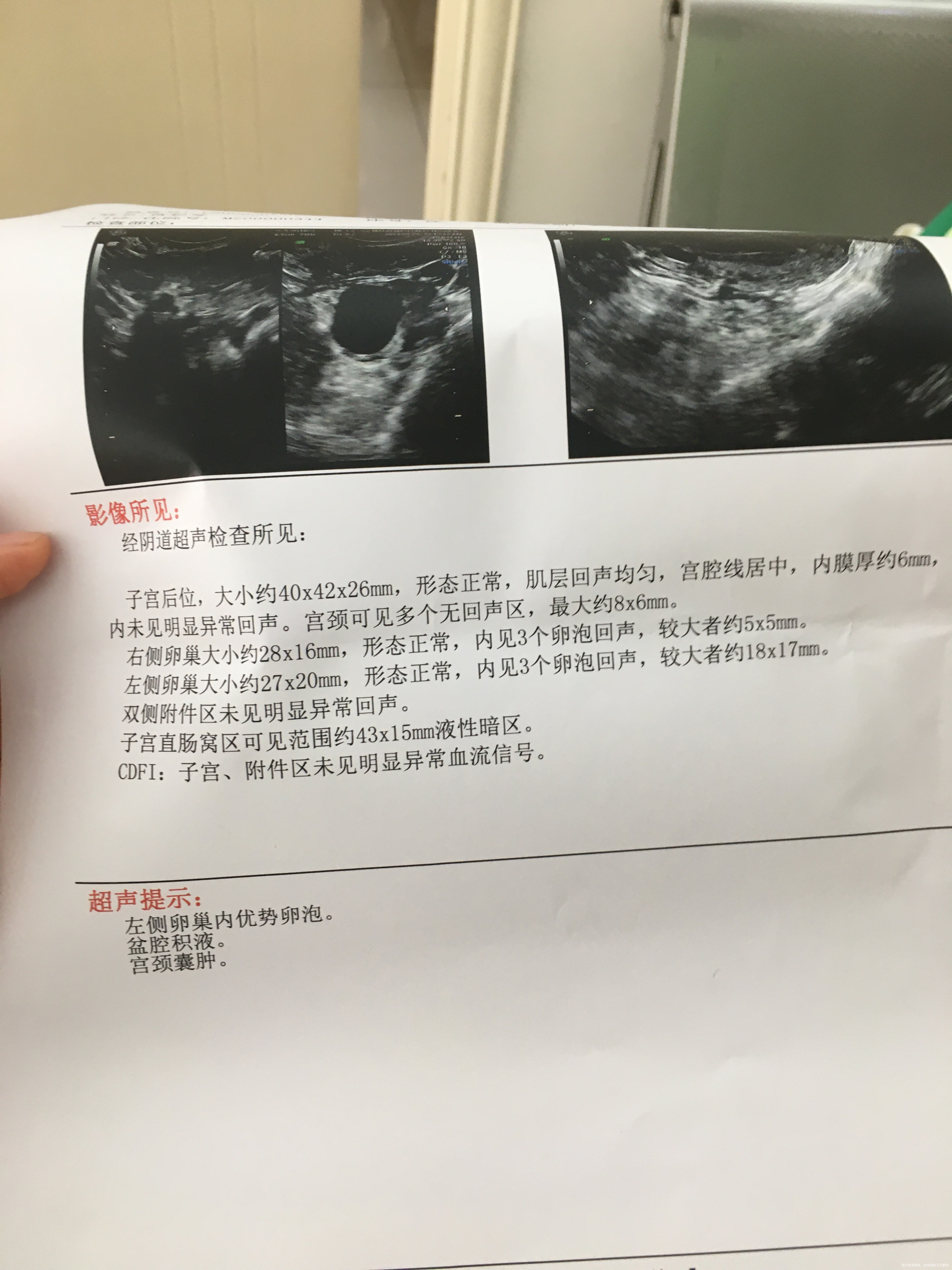 医生您好我今天是月经结束的第二天去医院监测的