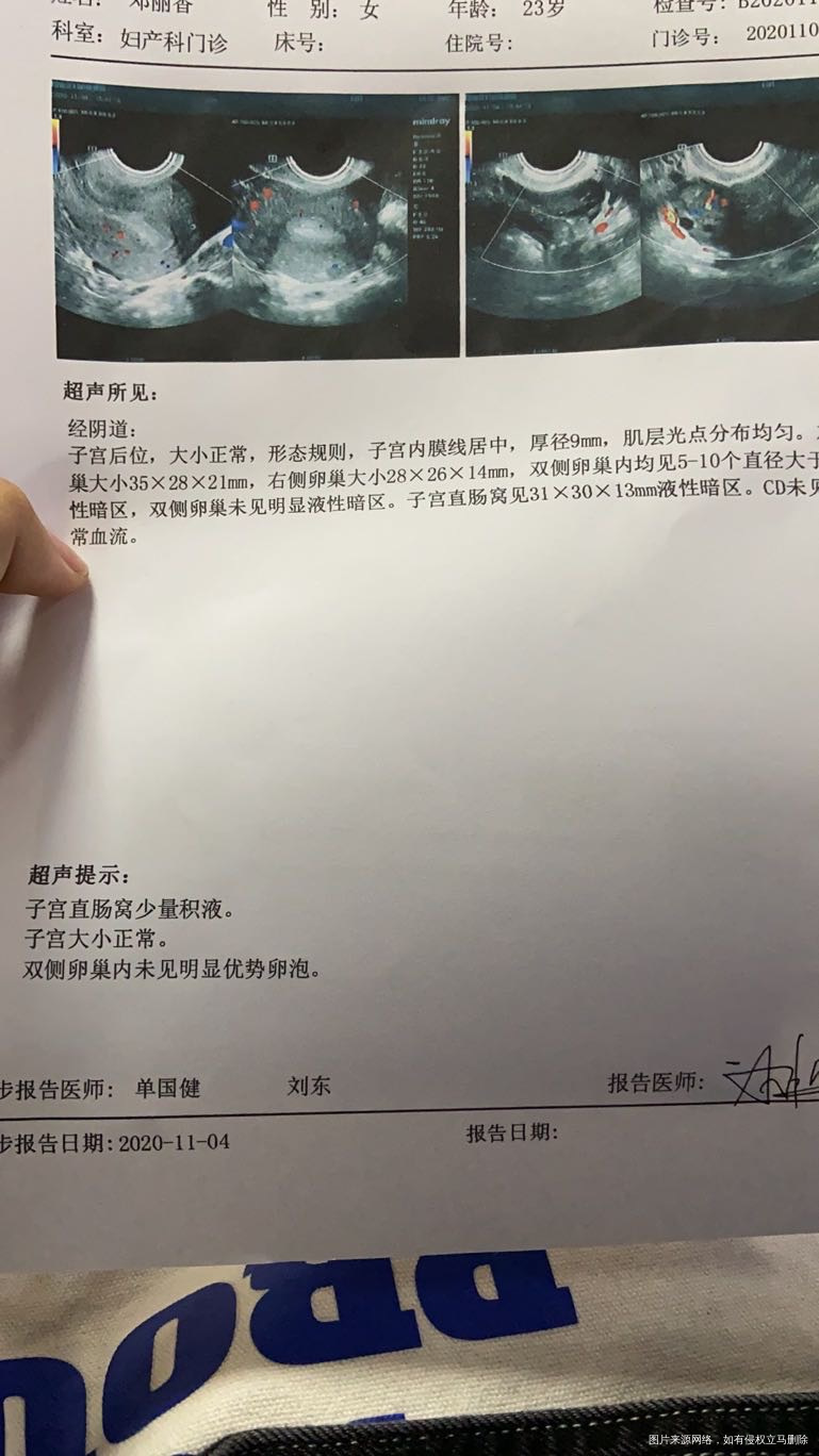 做过性激素六项没有问题做过输卵管造影没有问题