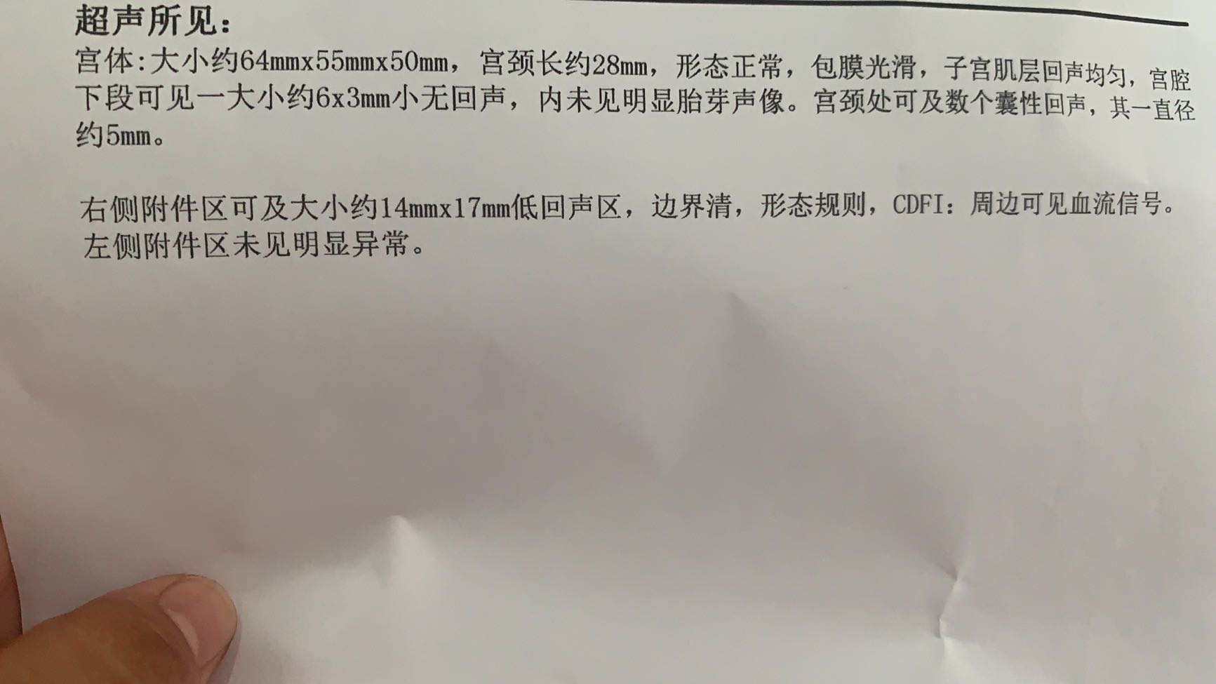 48日末次月经排卵推迟8天伴有出血