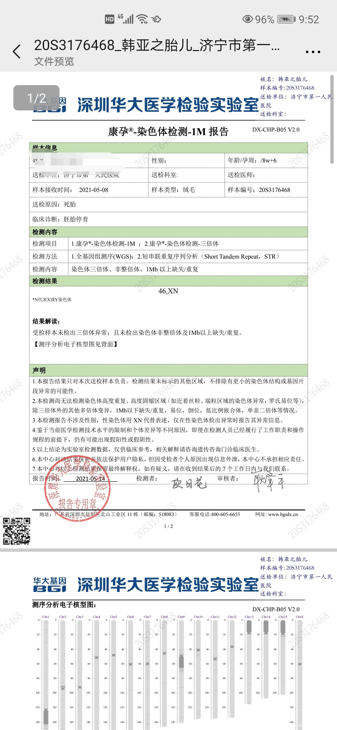 第一次移植鲜胚八周左右胎停以前没有胎停史ch