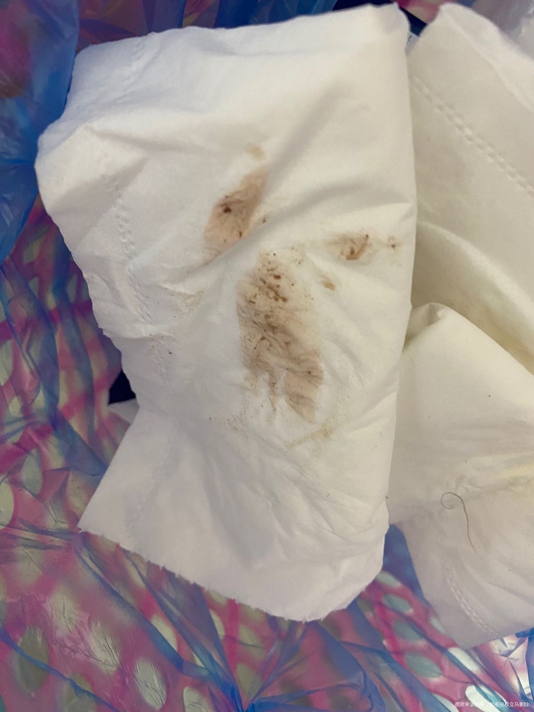 今天移植第26天不算移植日晚上感觉下面有分泌