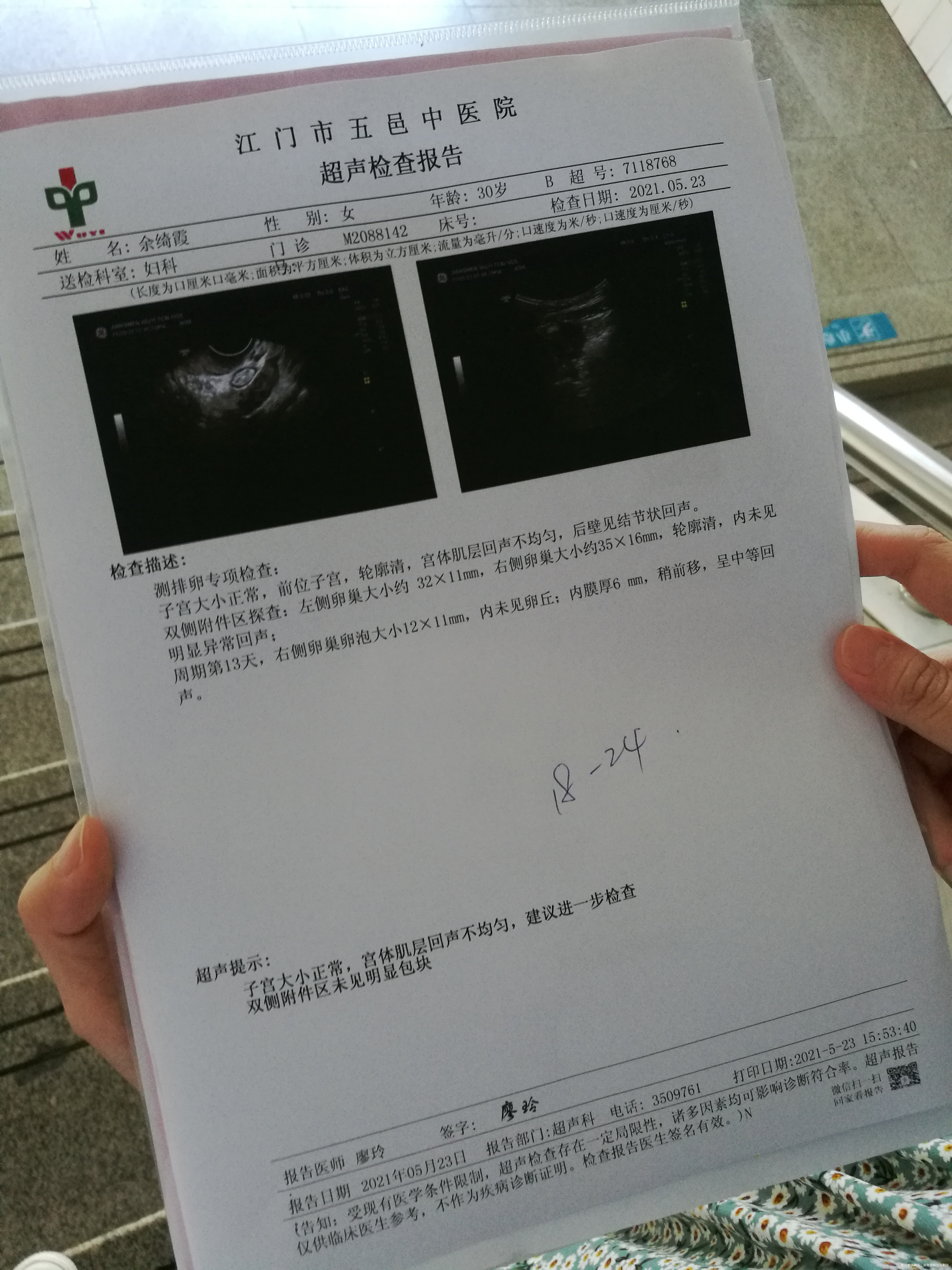 我老婆2021511517月经期排卵试纸显示