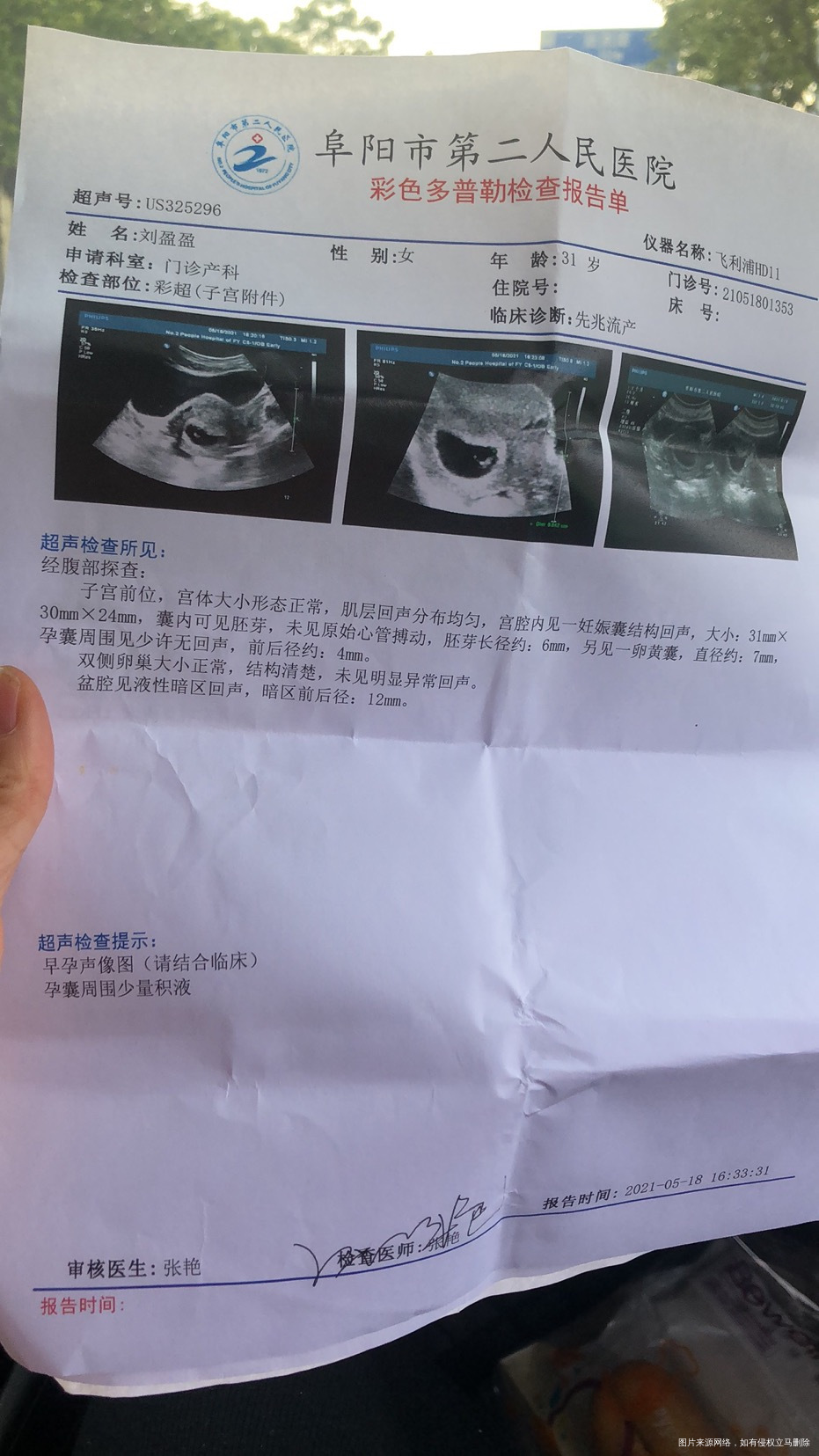 记不清未次月经是3月20还是3月255月6号