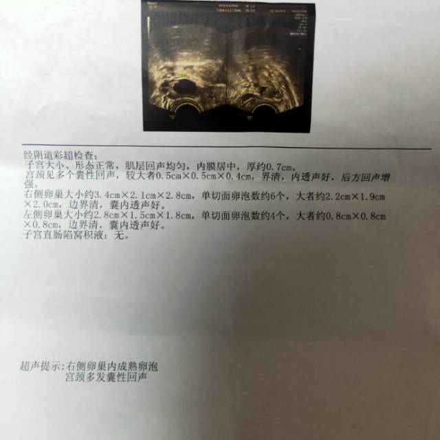 月经第10天检测大夫让同房然后第11天又去检