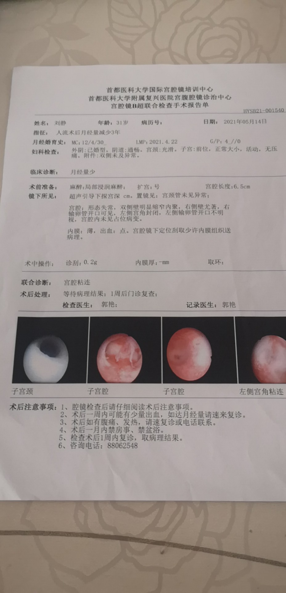 我已预约您6月7日的宫腔镜手术通知我3号去术