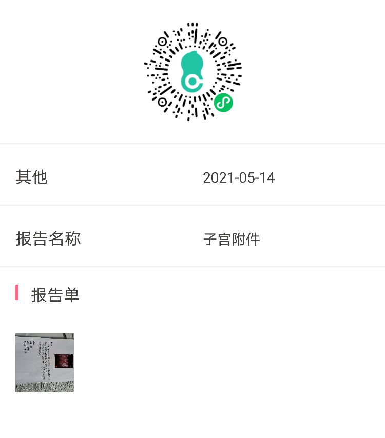 月经干净第五天做的检查内膜厚怎么办左侧卵巢那