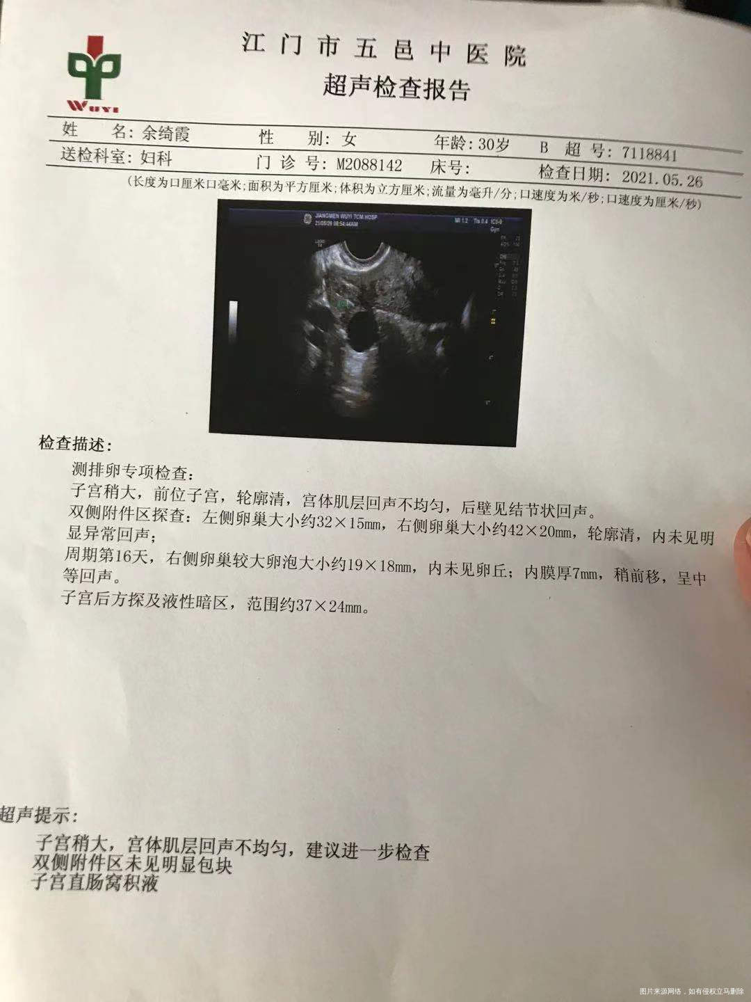 和老婆备孕3个月但没有成功怀孕想请问我们夫妻