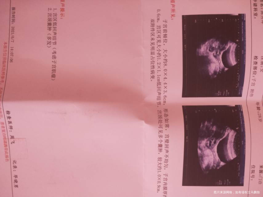 请主任帮我看一下我的问题严不严重这边的大夫没