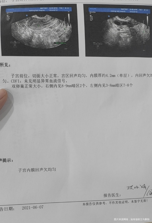 4月21号做完清宫术后内膜回声一直不均匀