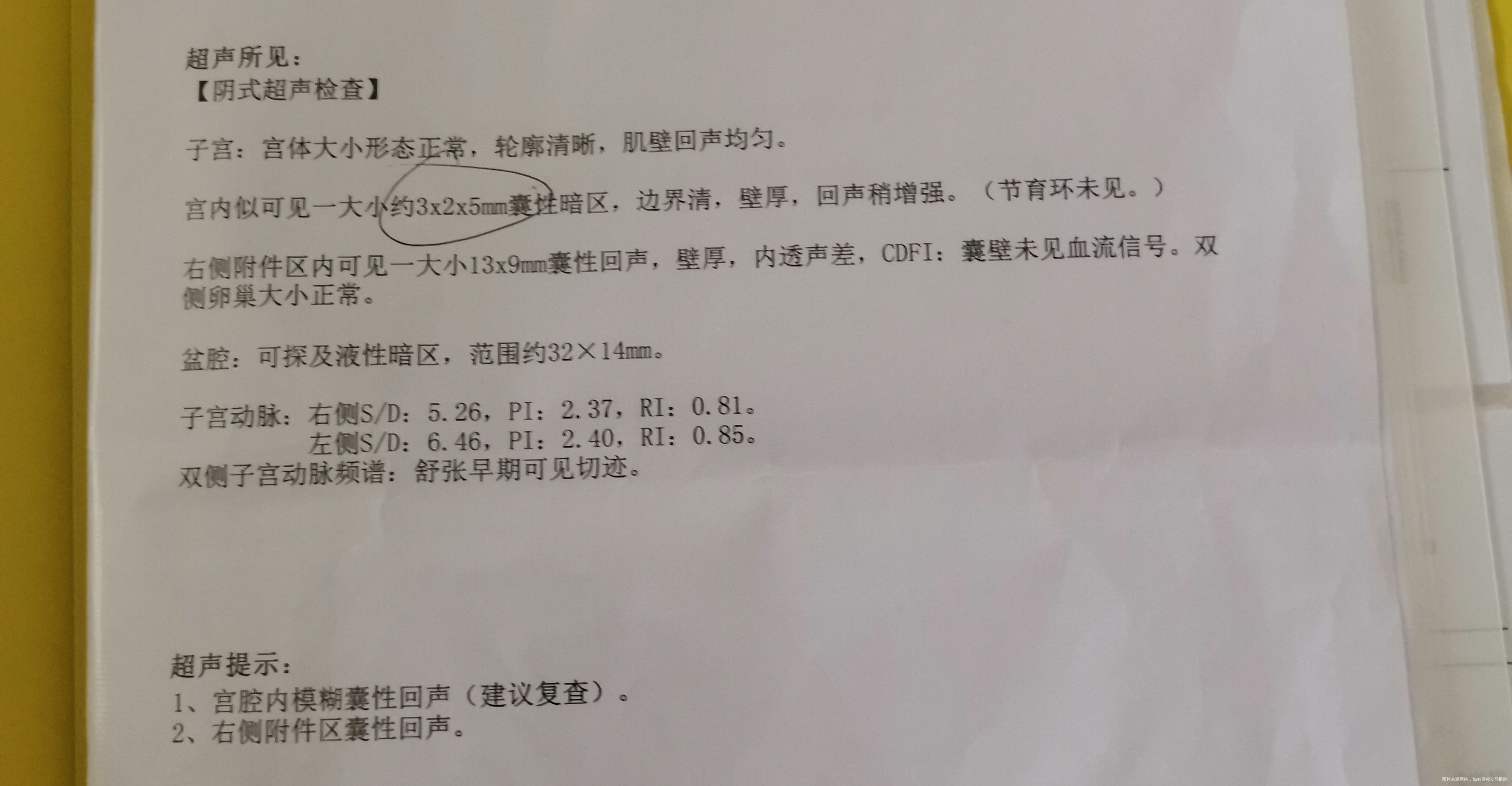 末次月经4月15月经有延迟延迟1到3天不等血