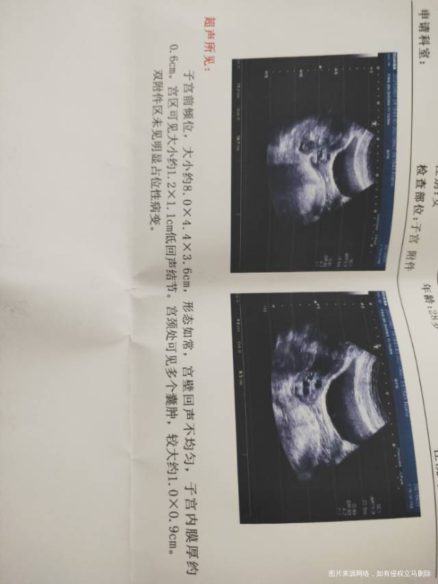 请主任帮我看一下我这个检查结果严不严重有点害