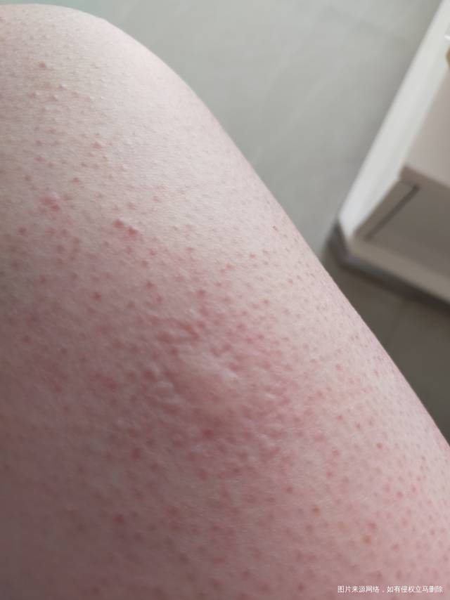 服用补佳乐每天早上4片吃了有十天了前两天身上