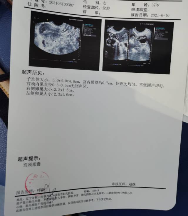 请问医生宫颈纳囊影响怀孕吗有没有不用做手术的