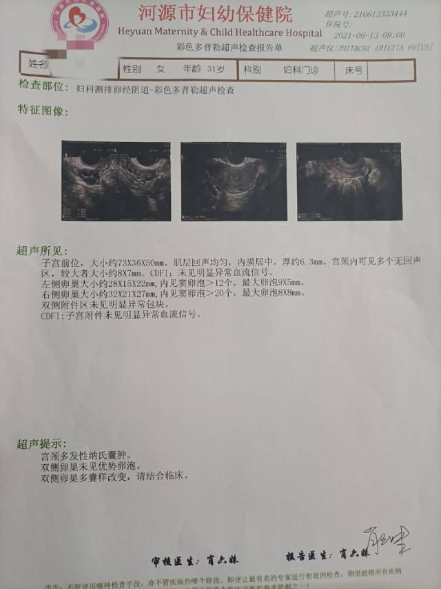 请问我的卵巢排卵是否异常跟吃补佳乐和地屈孕酮