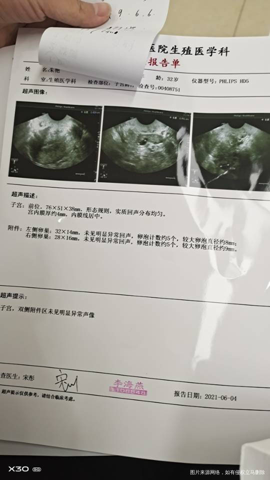 月经第二天去进周期结果医生说我卵泡有点大怀疑