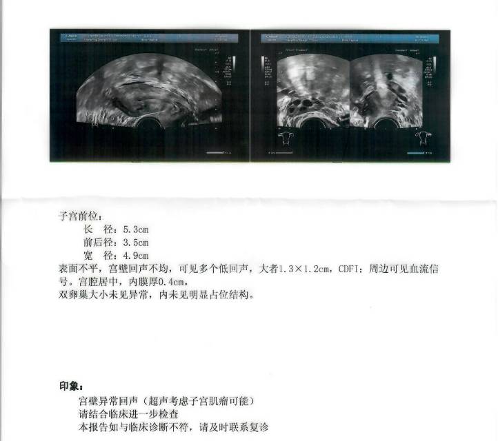 近期例假量特别少5月23日早八点做了彩超结果