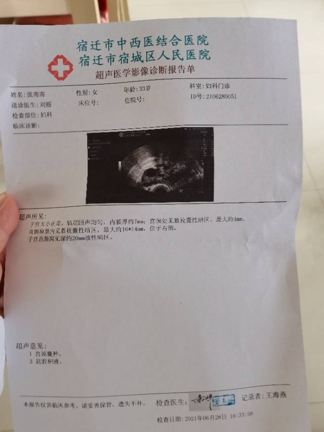 请问这是排过卵了吗盆腔积液用不用治疗