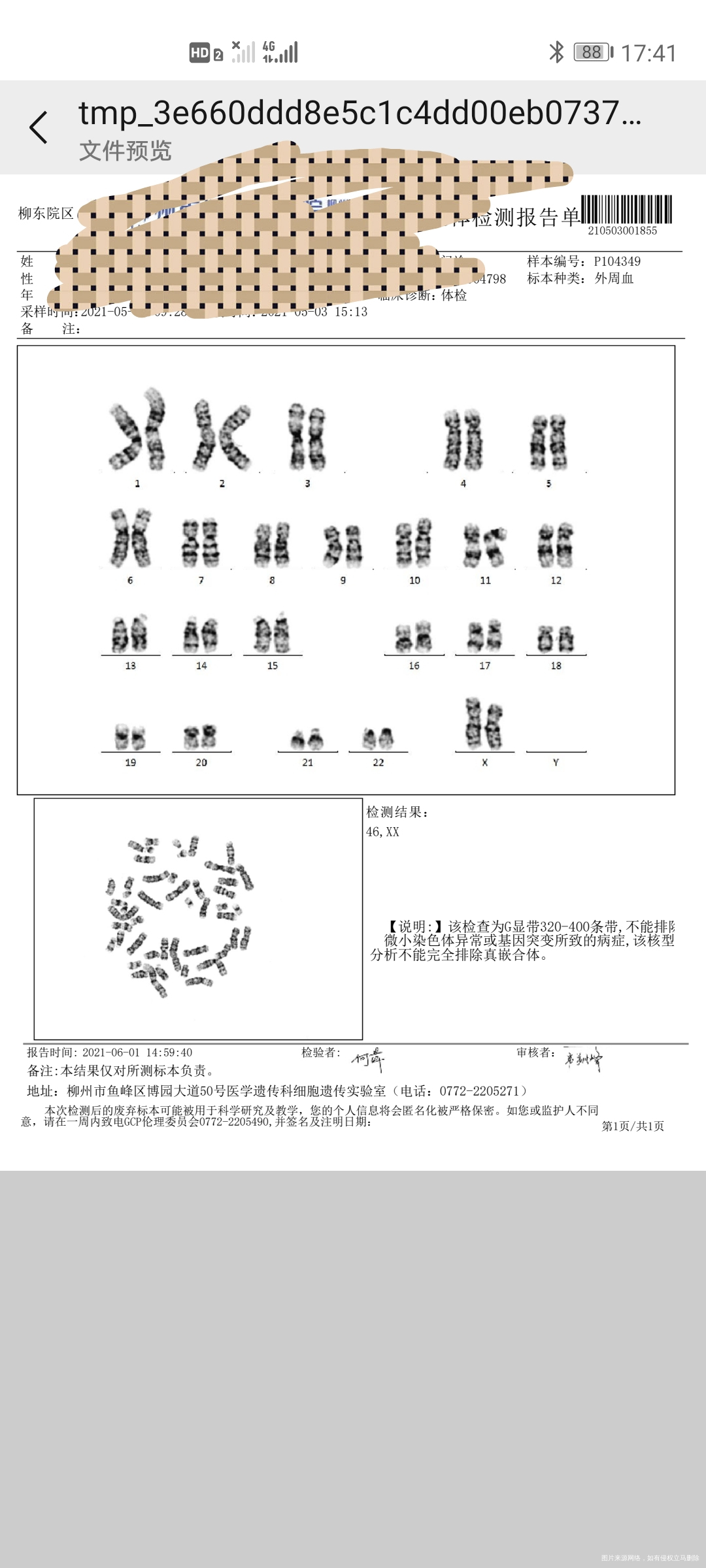 染色体检查这是正常的吗