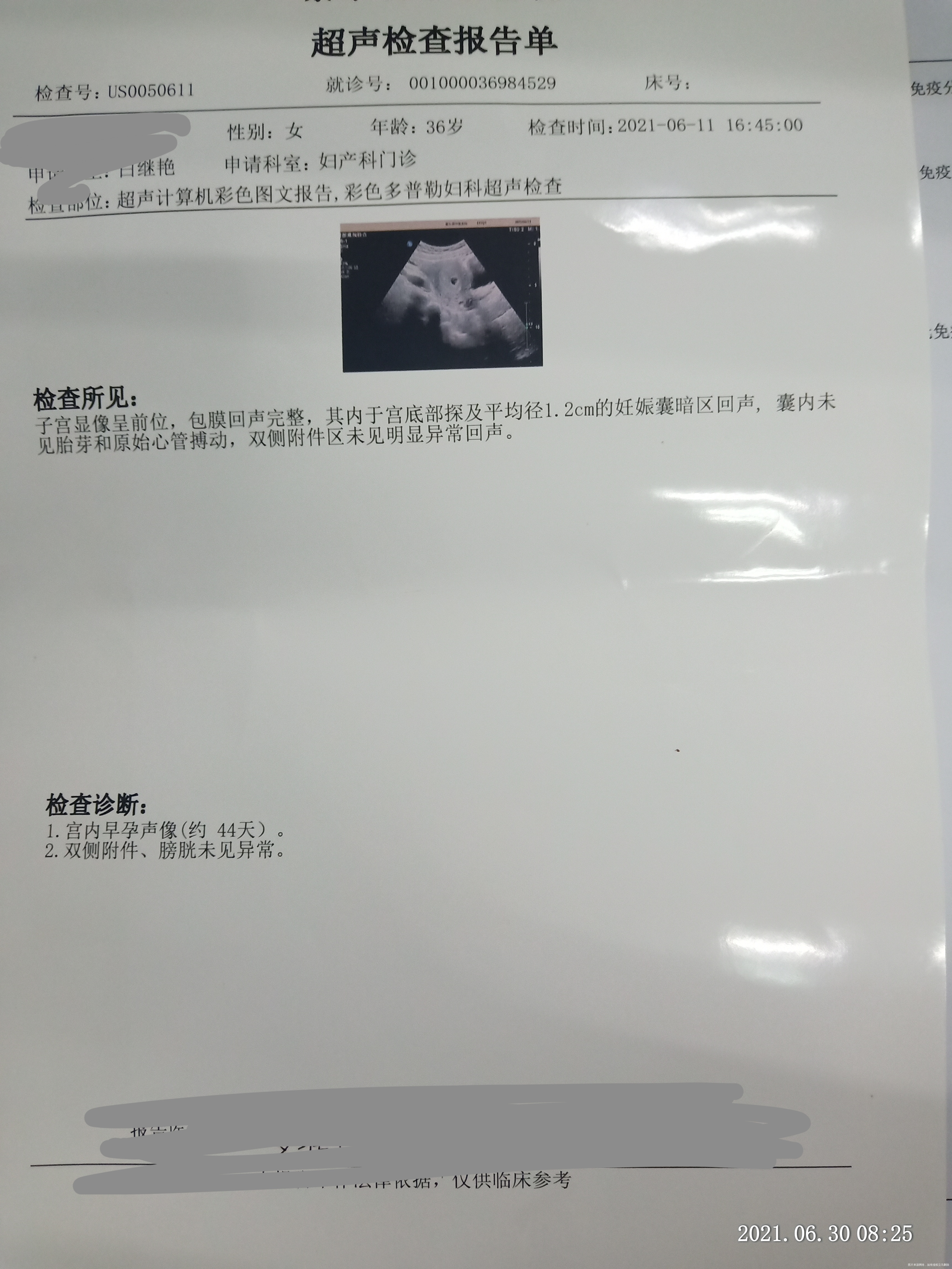 通常月经两三个月推迟一周左右不是很规律末次月