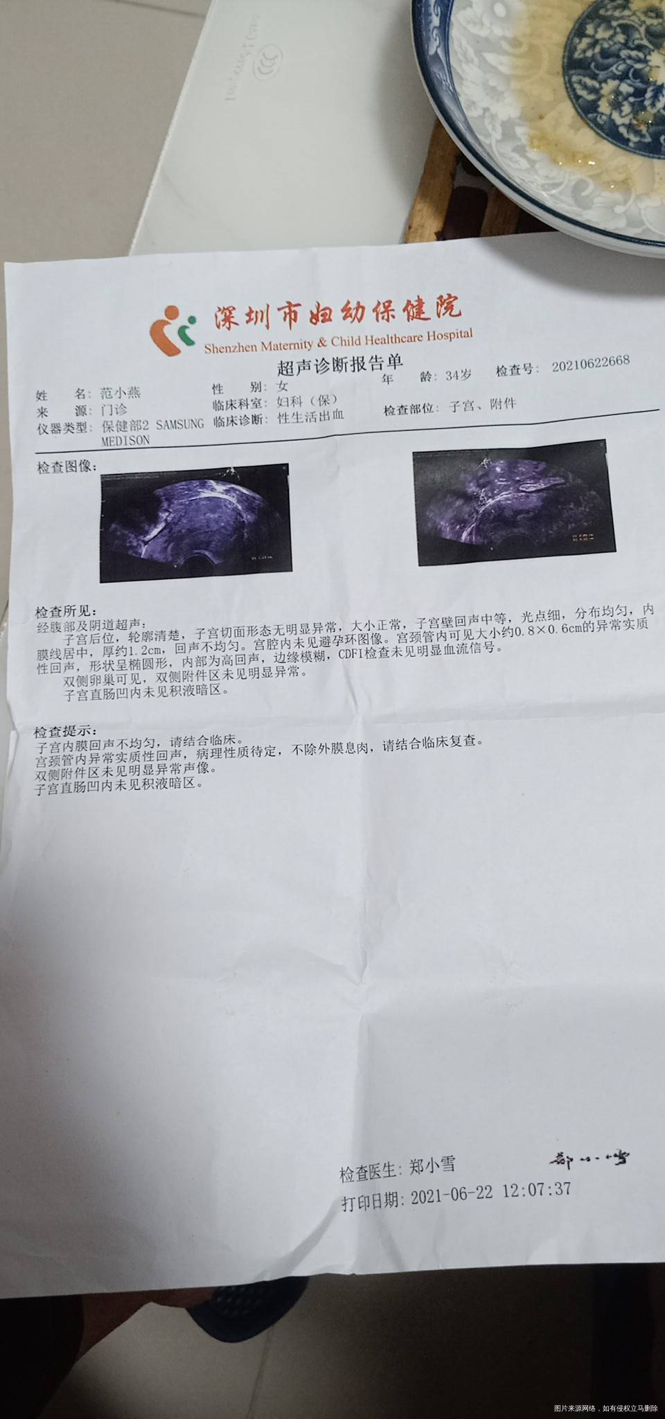 您好医生本人今年35岁在备孕中前几天做了妇科