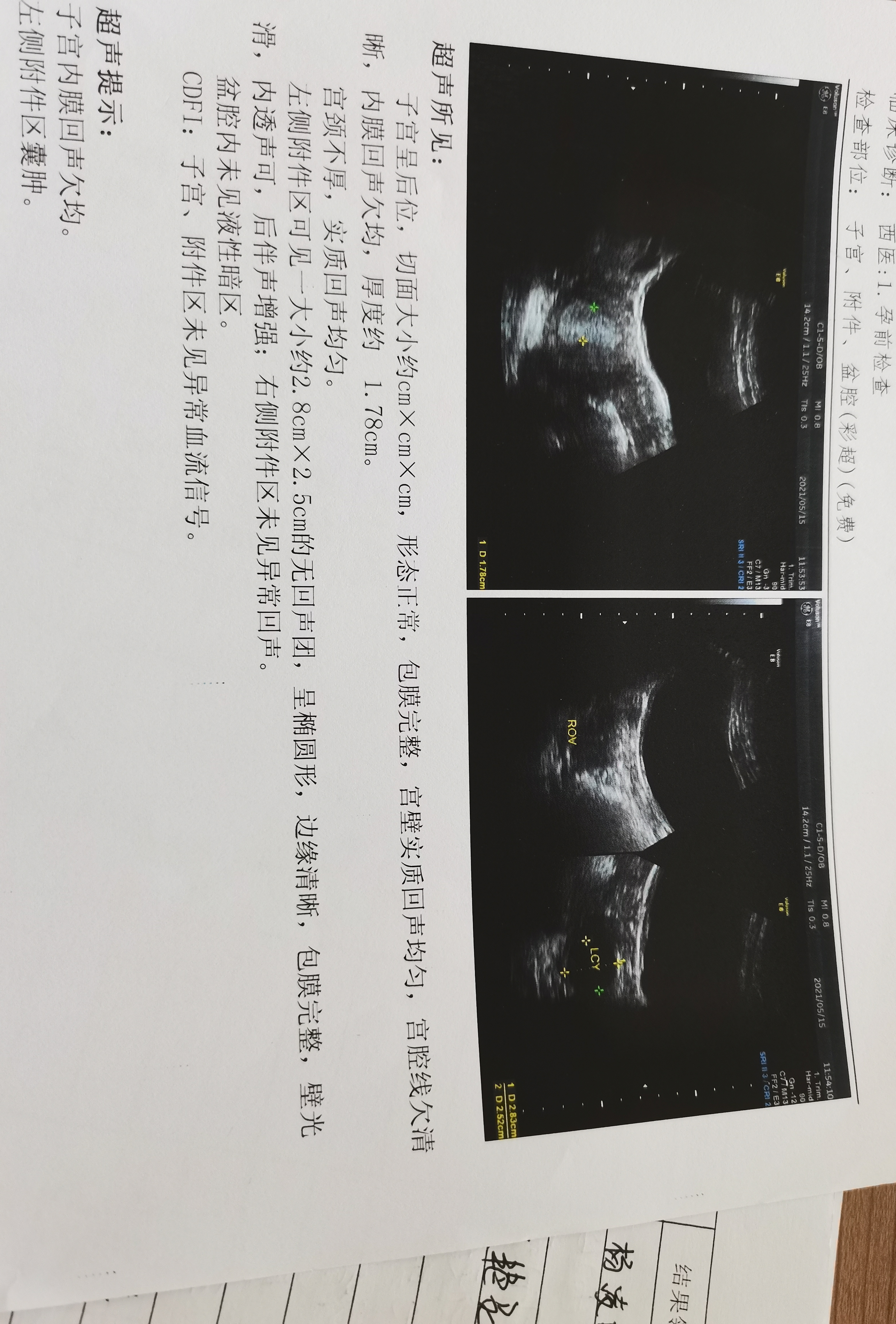 5月15号检查23号来月经的这个是附近囊肿怎