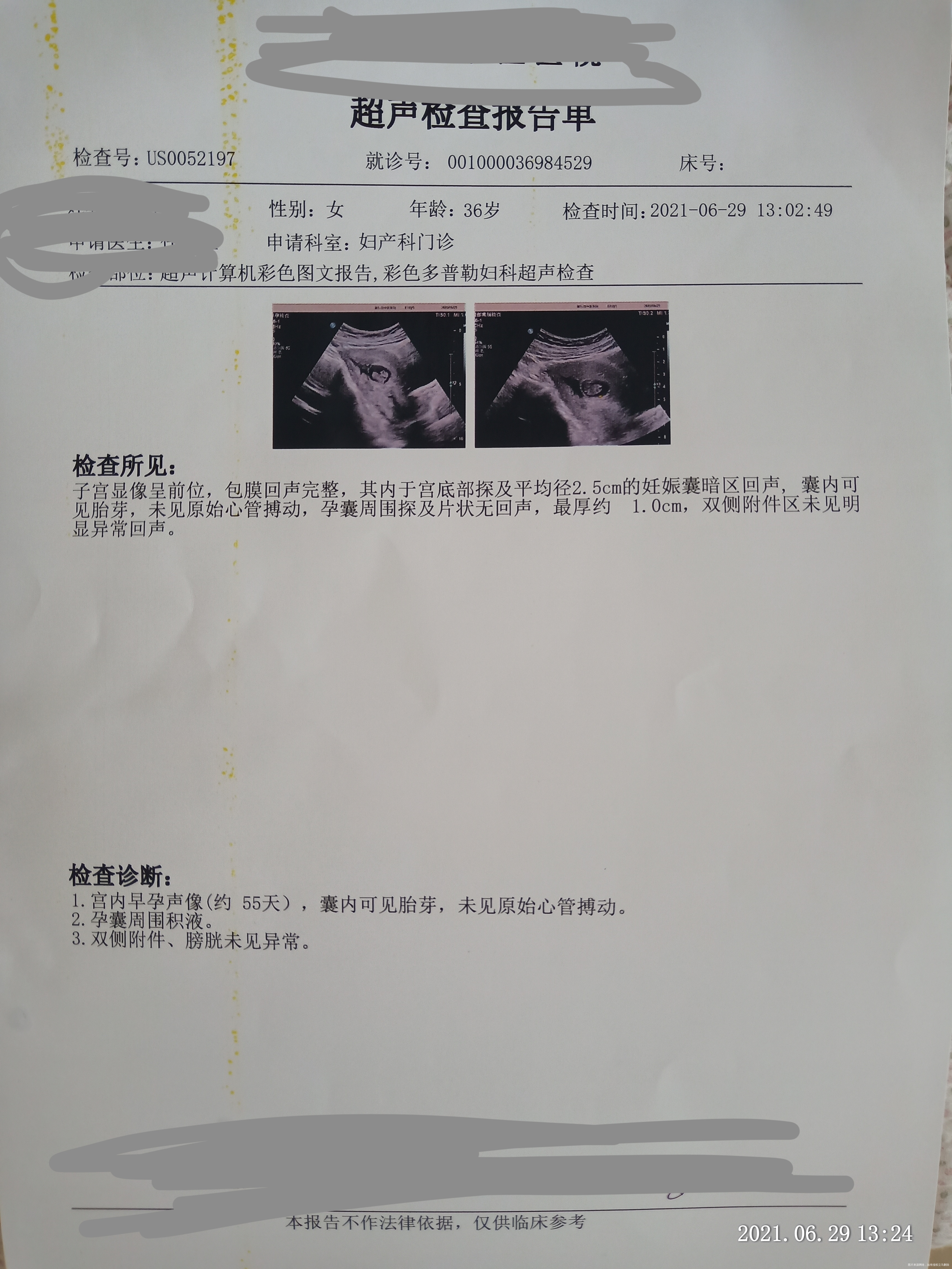 通常月经两三个月推迟一周左右不是很规律末次月