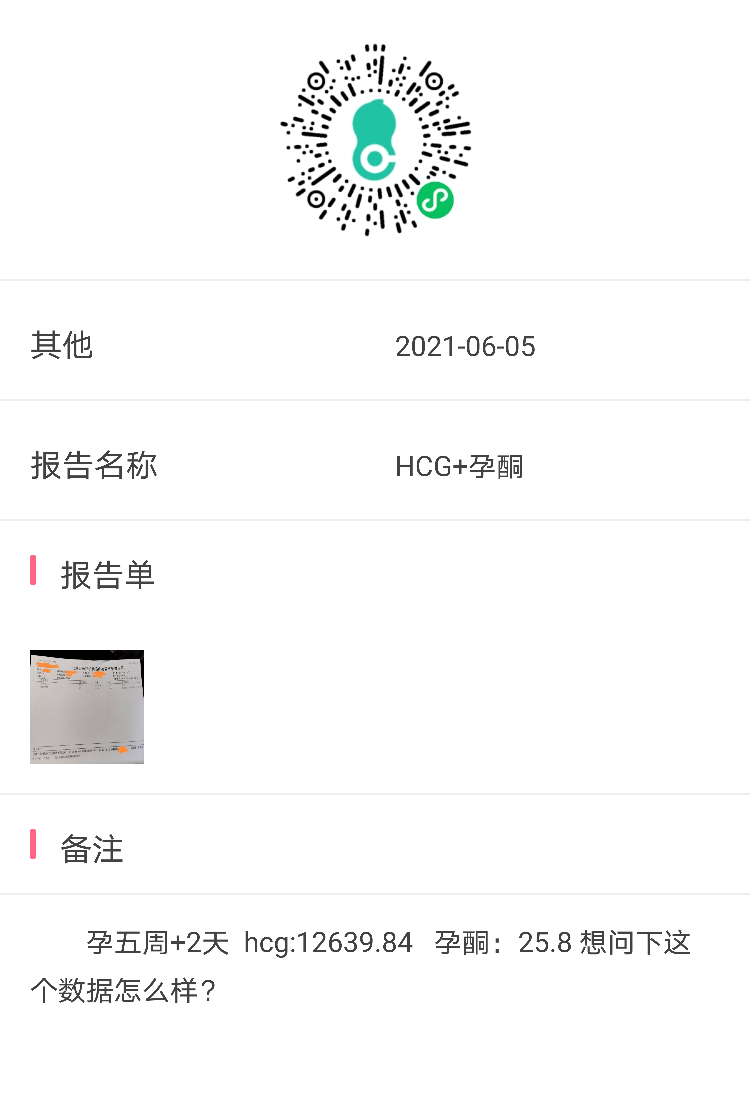 孕期5周+2天末次月经4月29日正常月经周期