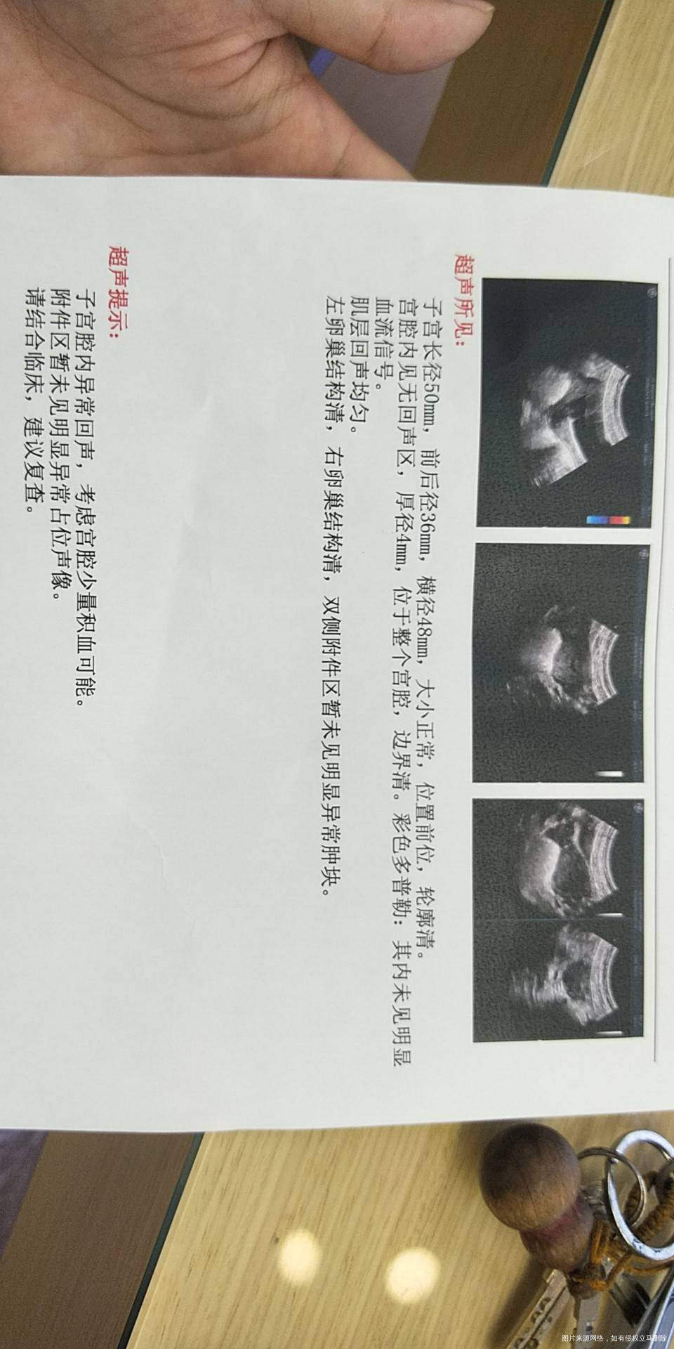 流产10天做的b超结果医生们能帮我看看吗