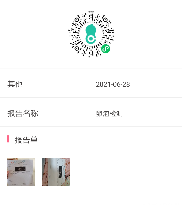 请问这是排过卵了吗盆腔积液用不用治疗