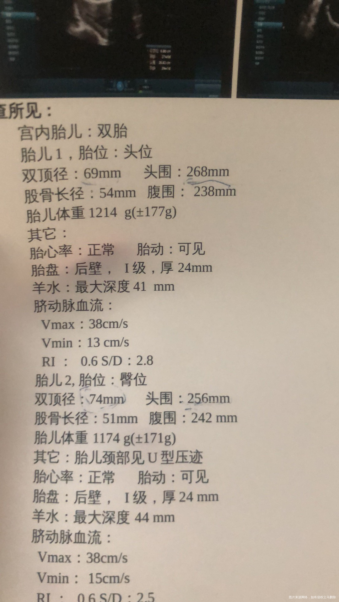 我想问下我这两个宝宝的双顶径和头围有问题吗