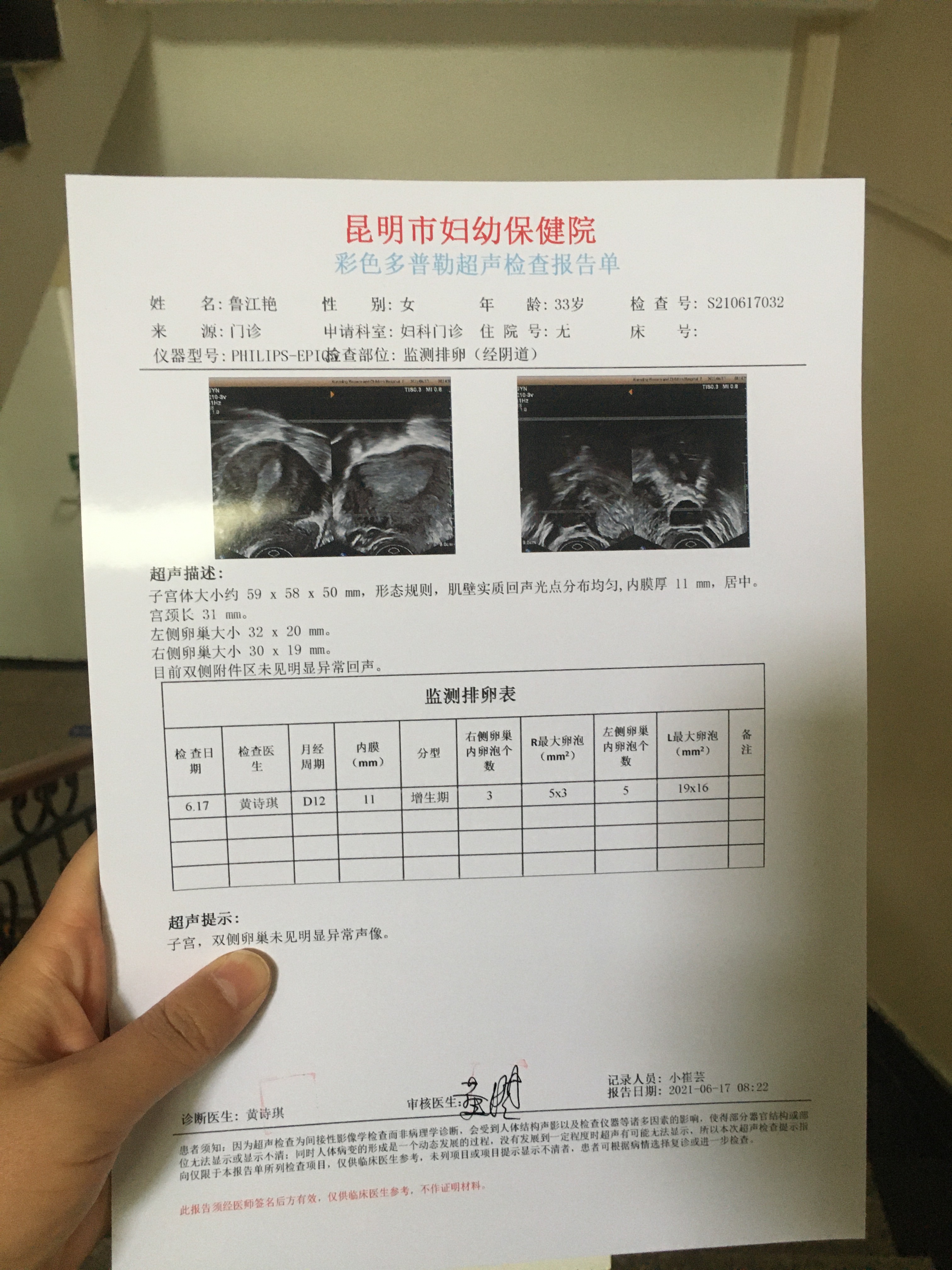 医生您好我卵巢早衰每个月卵泡能自己长大但是不