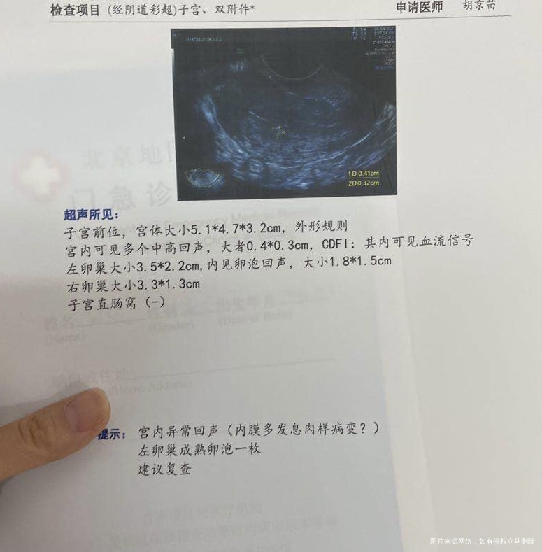 去年怀孕7周胎停过一次现在检查结果这样可以要