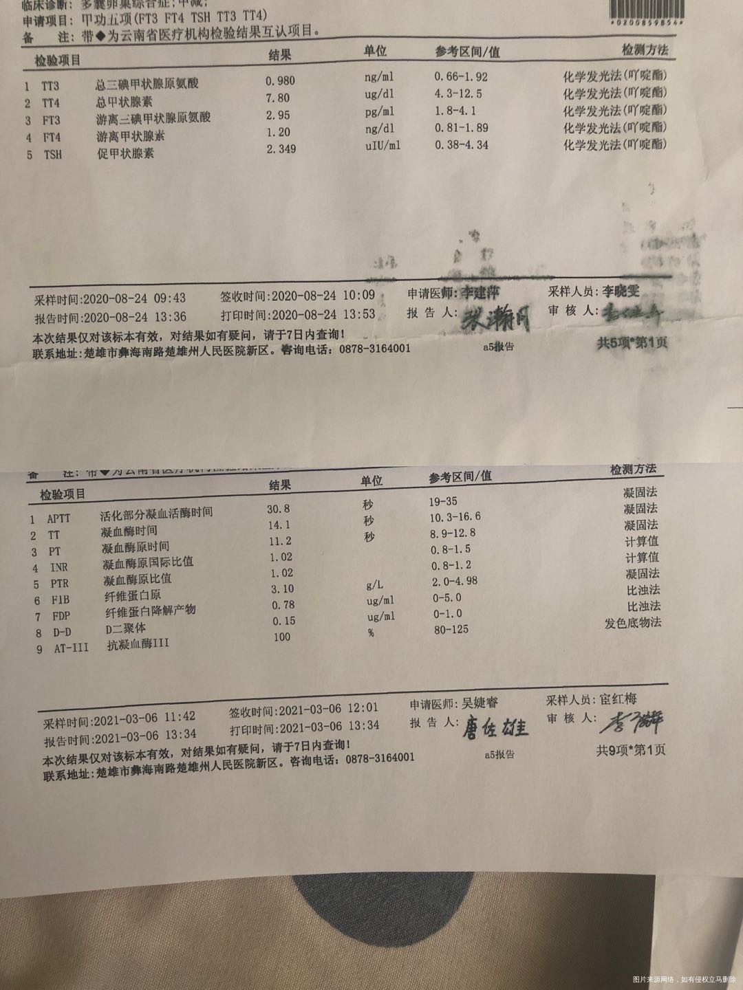 本人患多囊卵巢综合症促排四次未孕身高155体