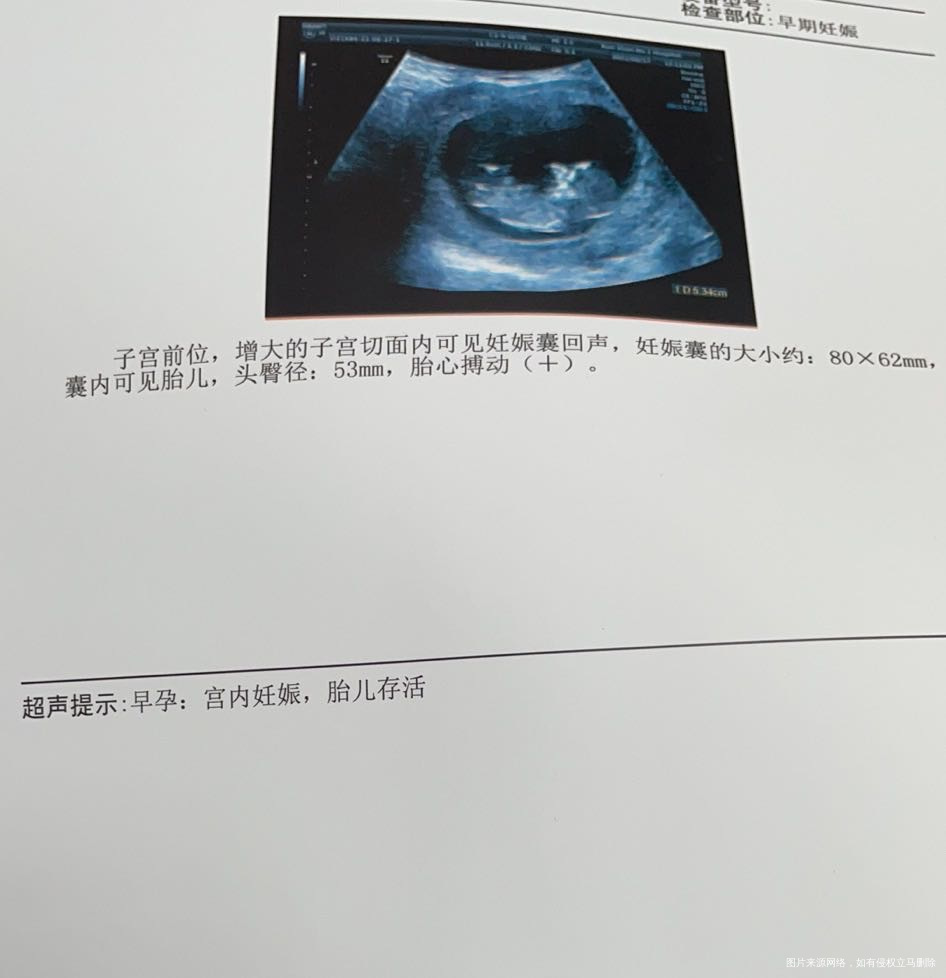 医生您好末次月经3/21今天腹部b超显示头臀