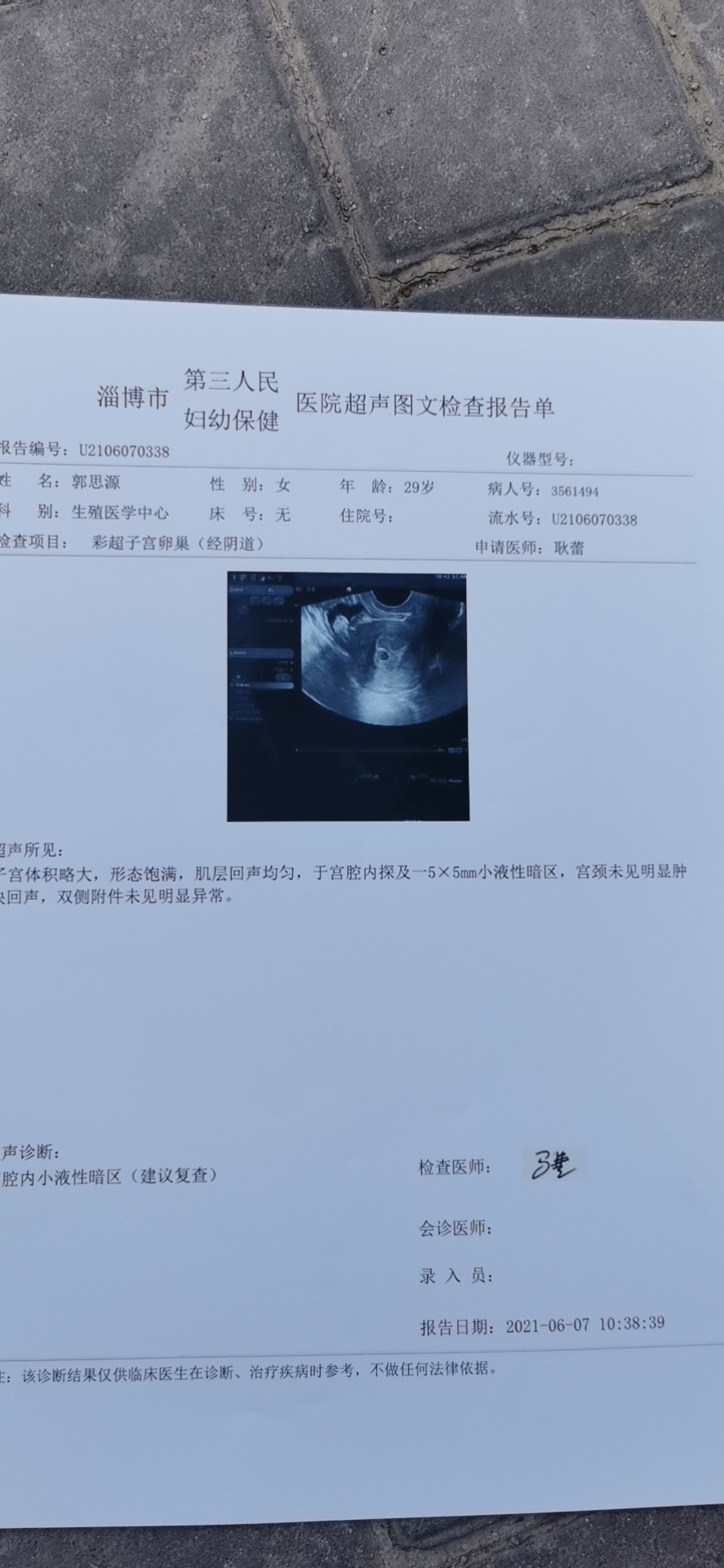 429来的末次月经周期是30天6月3日下午去